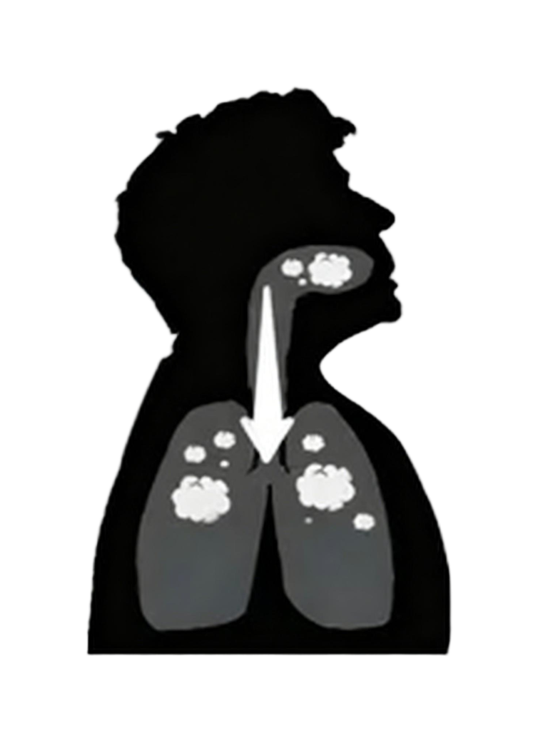 MTL vape technique diagram: Silhouette of vapor stored in mouth then inhaled into lungs.